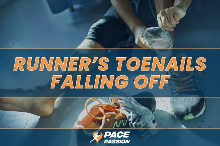 Runner’s Toenails Falling off: Causes, Prevention, Treatment